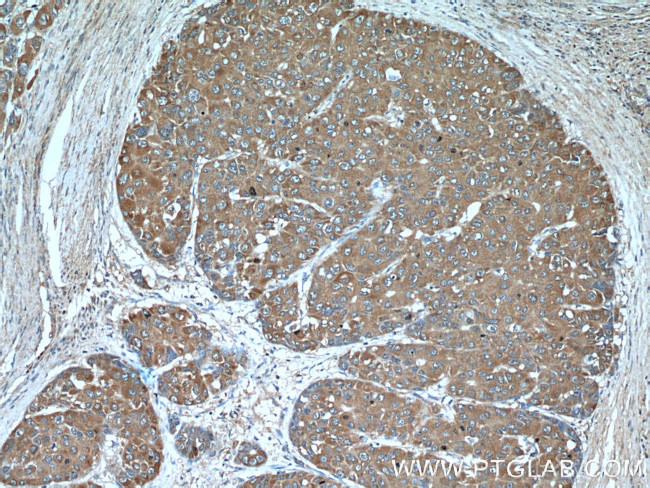 GCLM Antibody in Immunohistochemistry (Paraffin) (IHC (P))