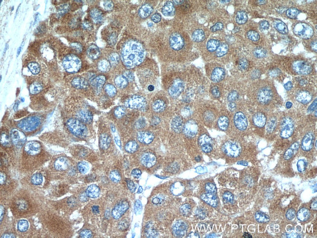 GCLM Antibody in Immunohistochemistry (Paraffin) (IHC (P))