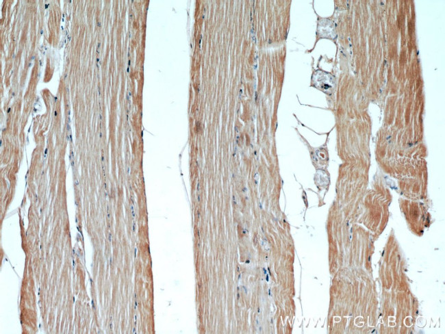 GCLM Antibody in Immunohistochemistry (Paraffin) (IHC (P))