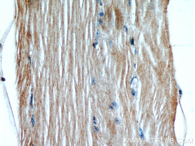 GCLM Antibody in Immunohistochemistry (Paraffin) (IHC (P))