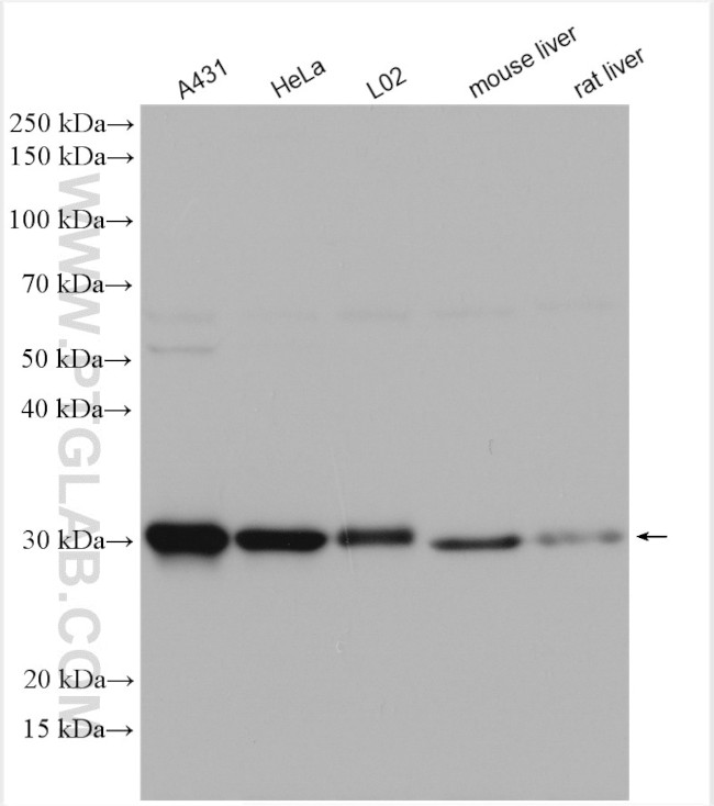 GCLM Antibody in Western Blot (WB)