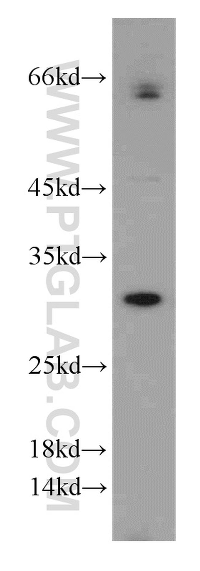 GCLM Antibody in Western Blot (WB)