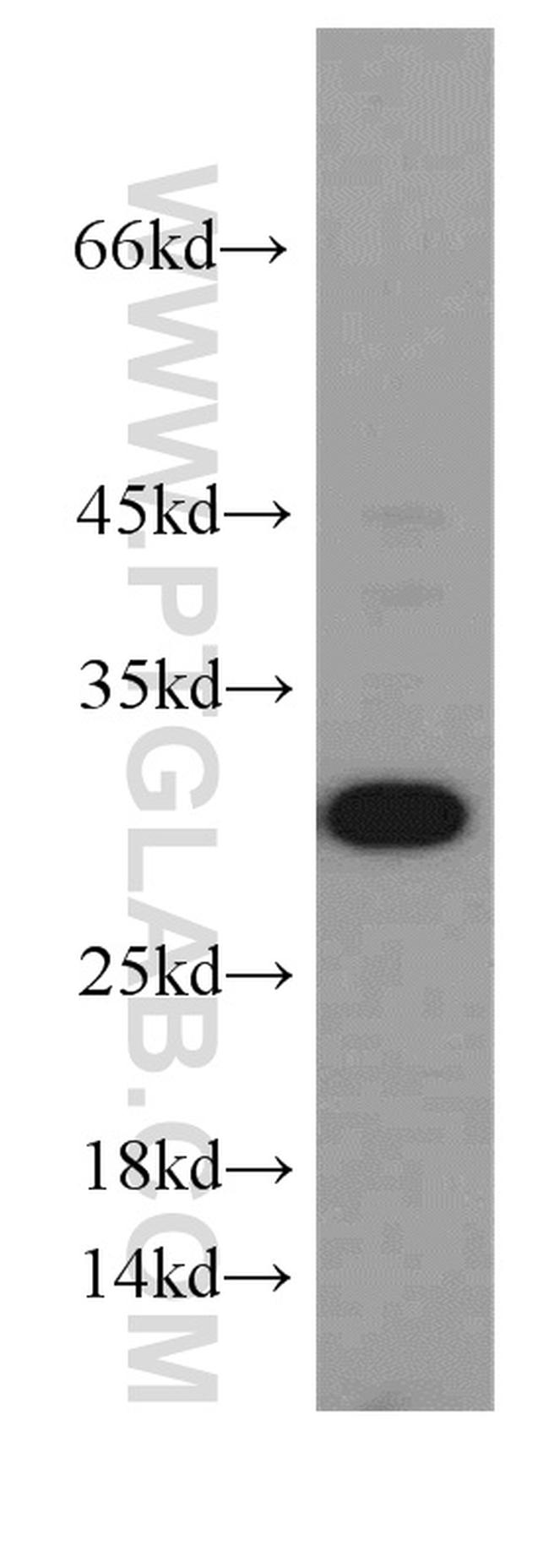 GCLM Antibody in Western Blot (WB)