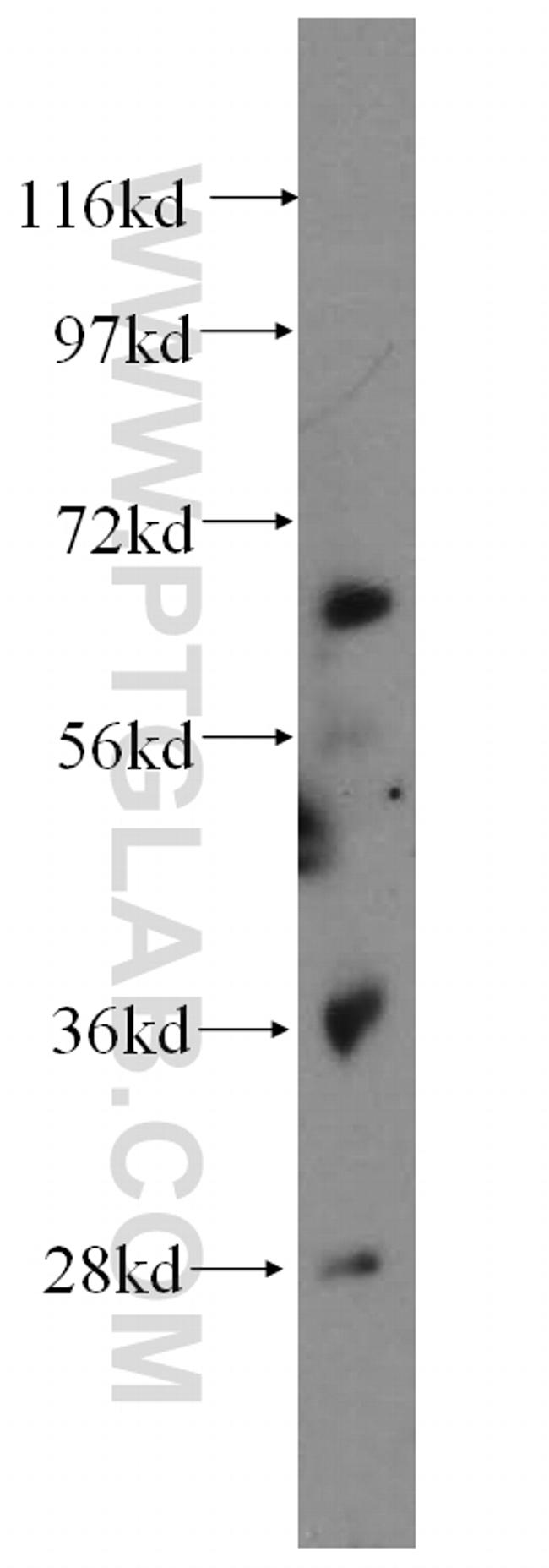 PIAS4 Antibody in Western Blot (WB)