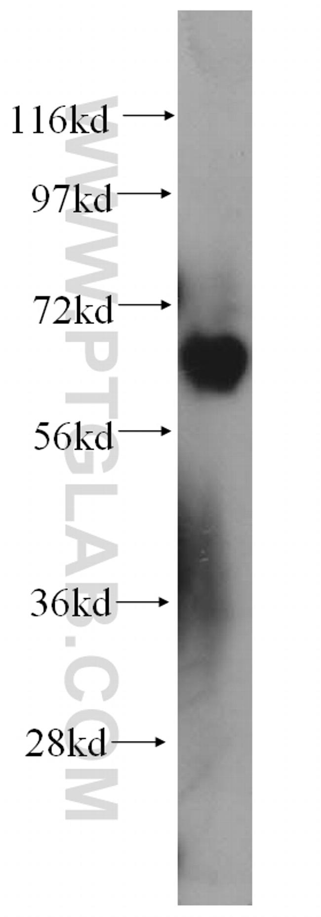 PIAS4 Antibody in Western Blot (WB)