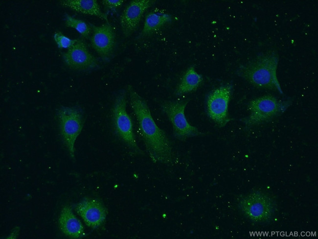 MMP19 Antibody in Immunocytochemistry (ICC/IF)