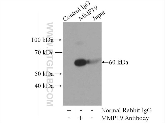 MMP19 Antibody in Immunoprecipitation (IP)