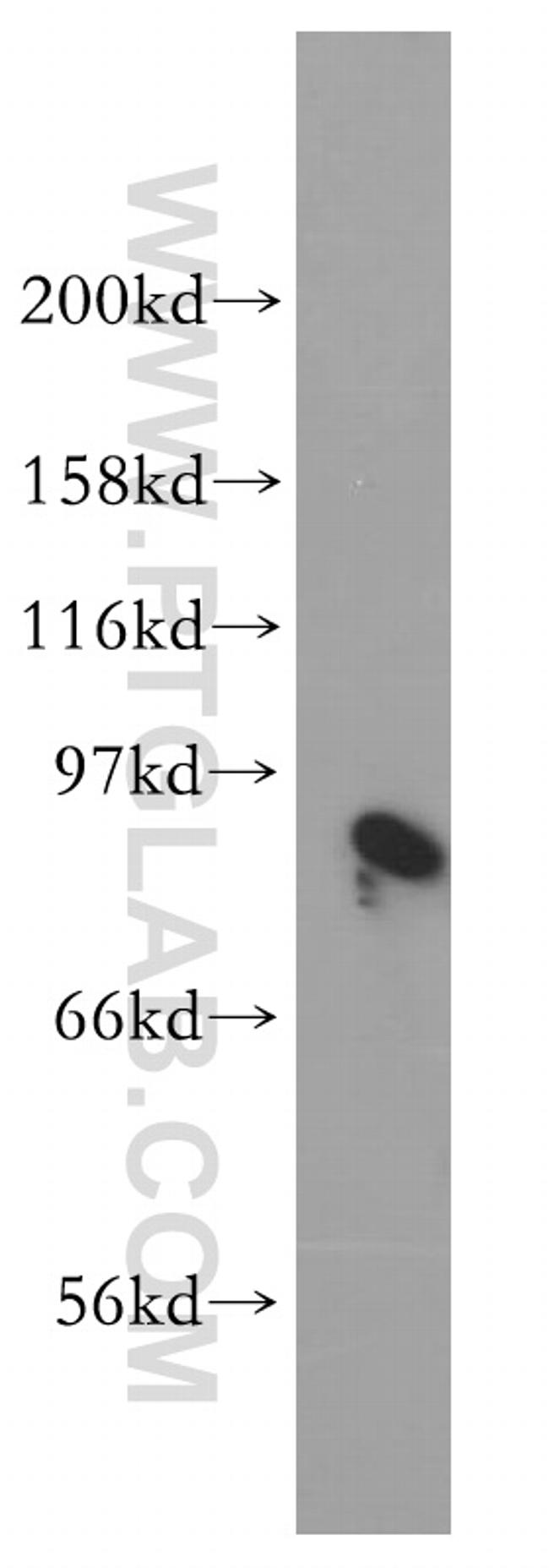 BIN2 Antibody in Western Blot (WB)