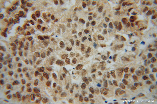 NR2E3 Antibody in Immunohistochemistry (Paraffin) (IHC (P))