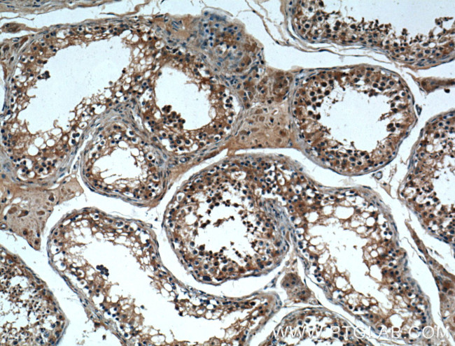 MSRB3 Antibody in Immunohistochemistry (Paraffin) (IHC (P))