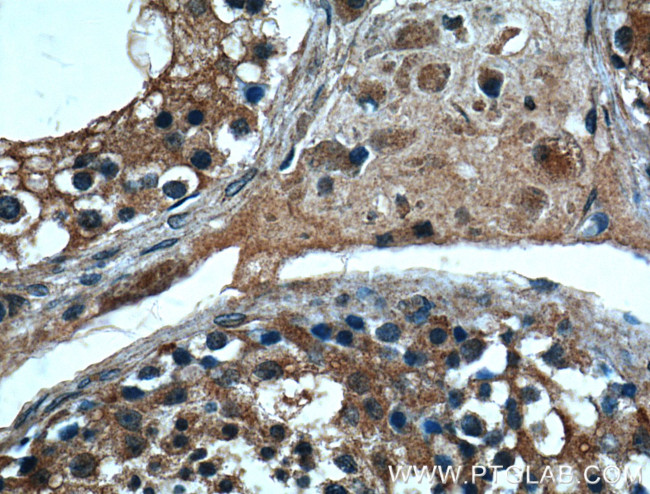 MSRB3 Antibody in Immunohistochemistry (Paraffin) (IHC (P))