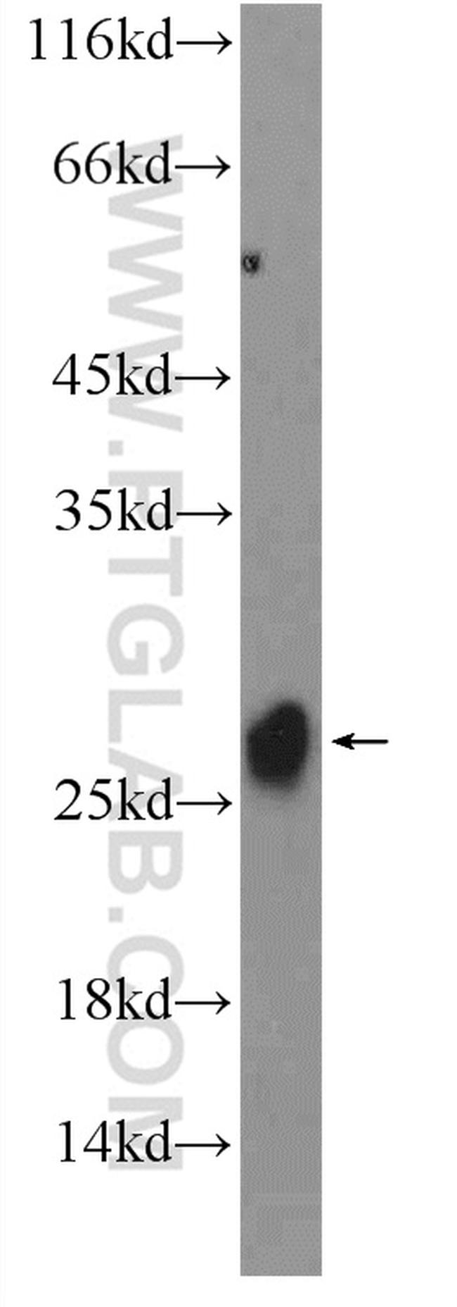 MSRB3 Antibody in Western Blot (WB)