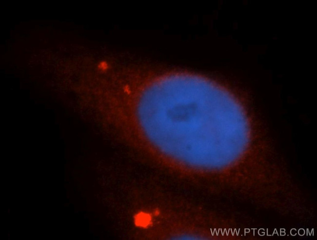 UBL4A Antibody in Immunocytochemistry (ICC/IF)