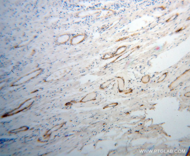 UBL4A Antibody in Immunohistochemistry (Paraffin) (IHC (P))