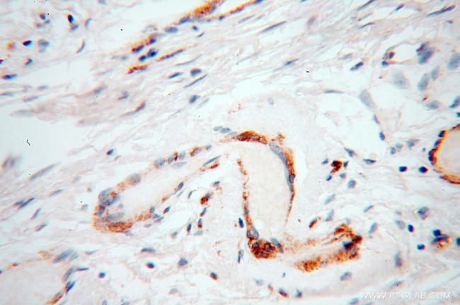 UBL4A Antibody in Immunohistochemistry (Paraffin) (IHC (P))