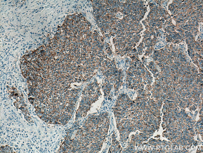 NCAM1/CD56 Antibody in Immunohistochemistry (Paraffin) (IHC (P))