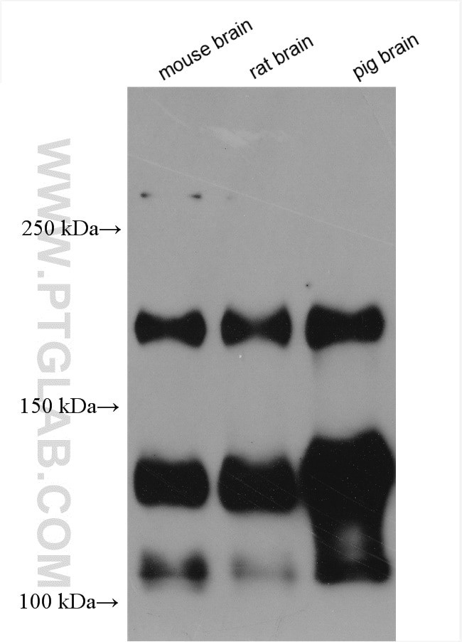 NCAM1/CD56 Antibody in Western Blot (WB)