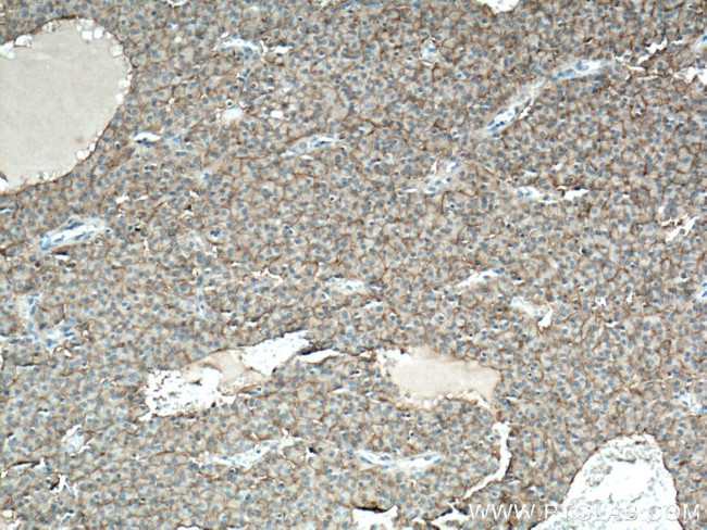 NCAM1/CD56 Antibody in Immunohistochemistry (Paraffin) (IHC (P))