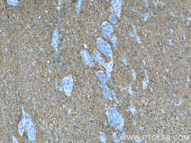 NCAM1/CD56 Antibody in Immunohistochemistry (Paraffin) (IHC (P))