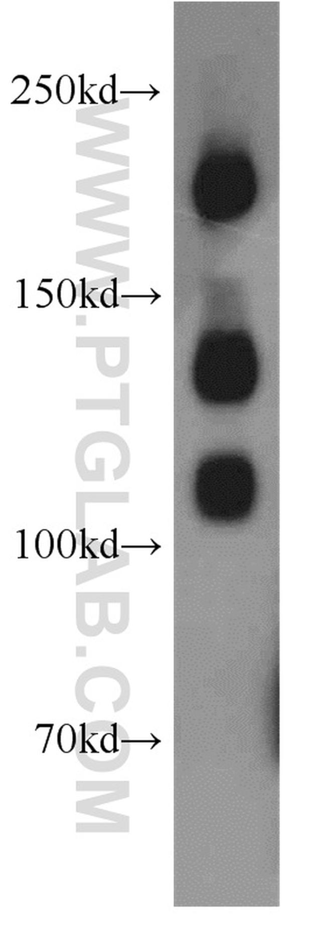 NCAM1/CD56 Antibody in Western Blot (WB)