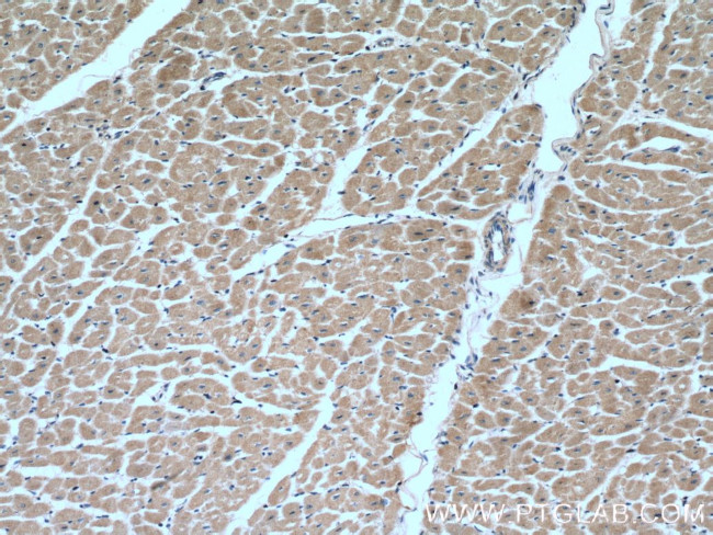 MTP18 Antibody in Immunohistochemistry (Paraffin) (IHC (P))