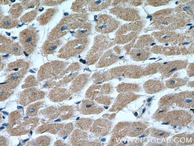 MTP18 Antibody in Immunohistochemistry (Paraffin) (IHC (P))