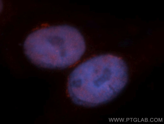 MBD3 Antibody in Immunocytochemistry (ICC/IF)