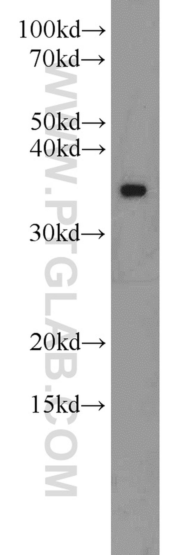 MBD3 Antibody in Western Blot (WB)