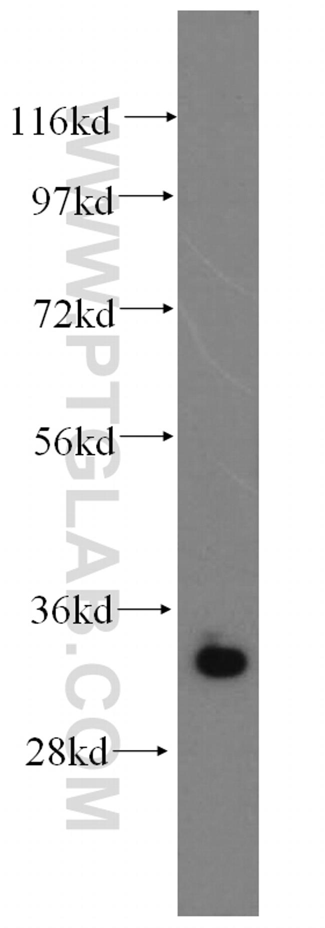 MBD3 Antibody in Western Blot (WB)