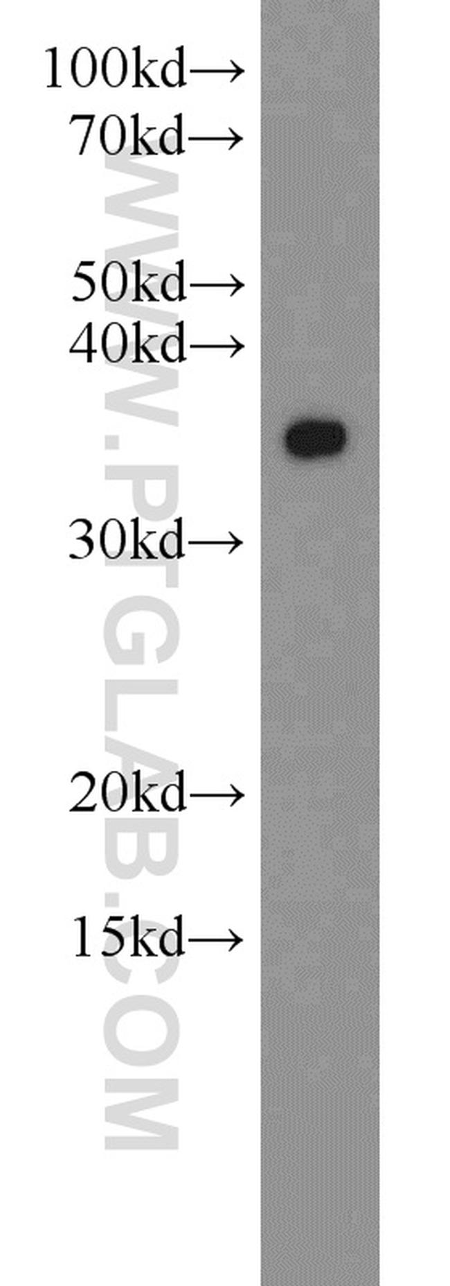 MBD3 Antibody in Western Blot (WB)