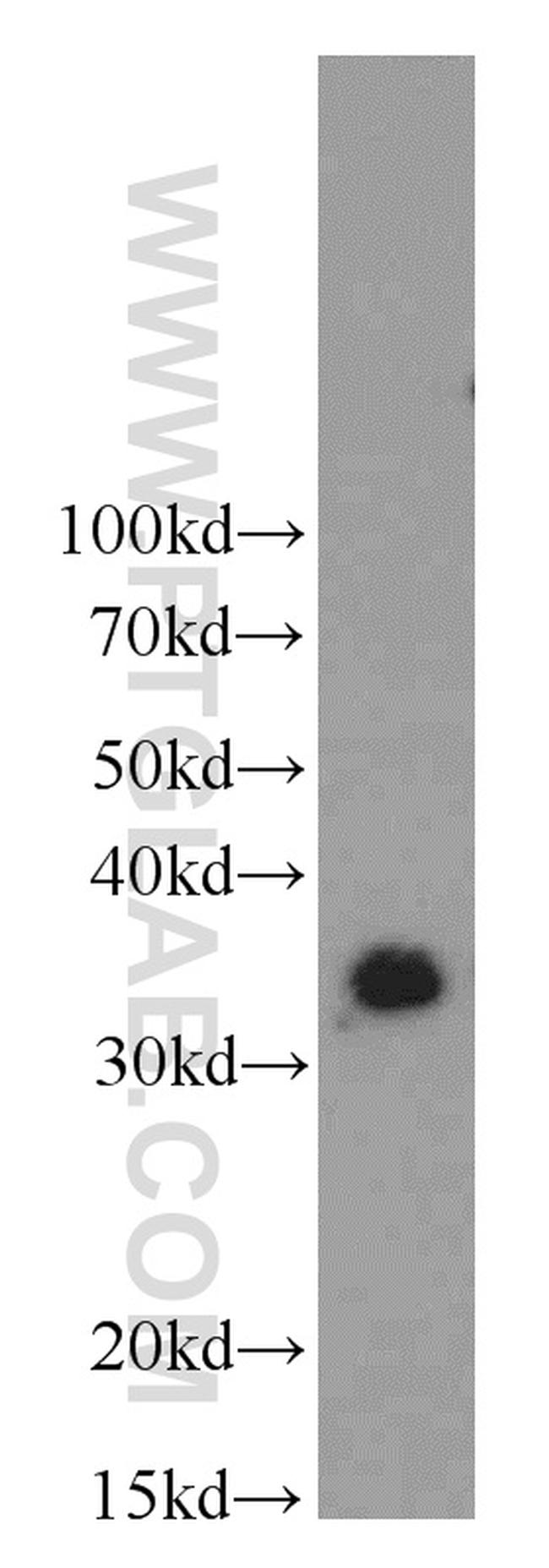 MBD3 Antibody in Western Blot (WB)