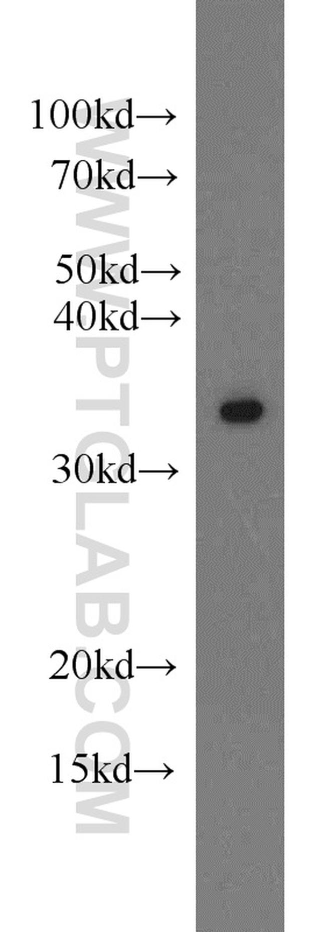MBD3 Antibody in Western Blot (WB)