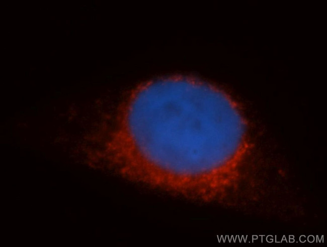 Syntaxin 12 Antibody in Immunocytochemistry (ICC/IF)