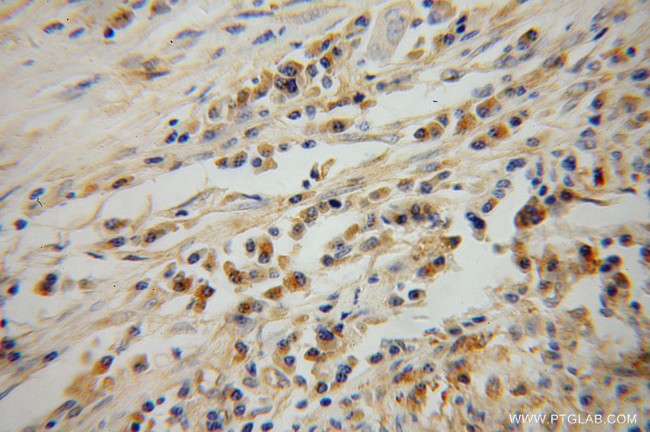 Syntaxin 12 Antibody in Immunohistochemistry (Paraffin) (IHC (P))