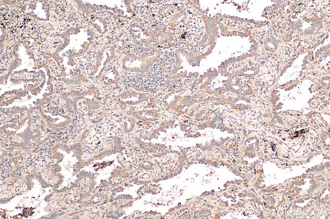 Syntaxin 12 Antibody in Immunohistochemistry (Paraffin) (IHC (P))