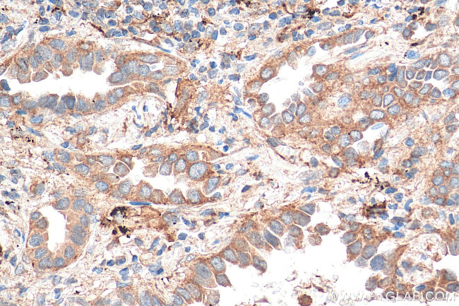 Syntaxin 12 Antibody in Immunohistochemistry (Paraffin) (IHC (P))