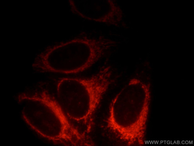 Syntaxin 12 Antibody in Immunocytochemistry (ICC/IF)