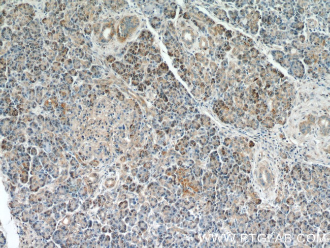 Syntaxin 12 Antibody in Immunohistochemistry (Paraffin) (IHC (P))