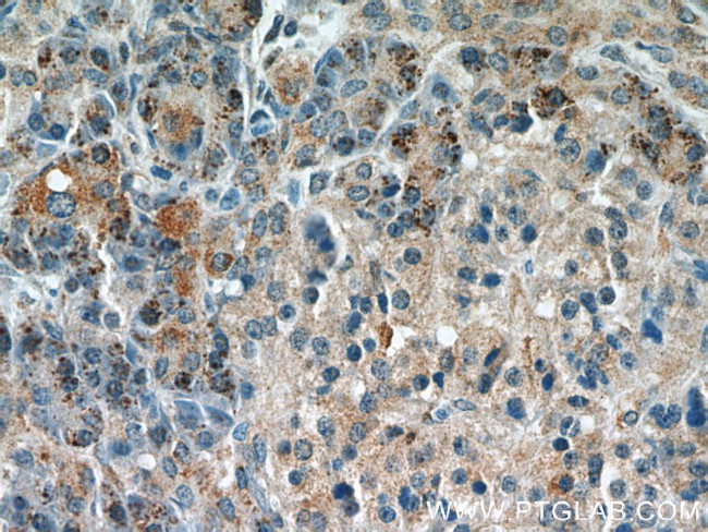 Syntaxin 12 Antibody in Immunohistochemistry (Paraffin) (IHC (P))