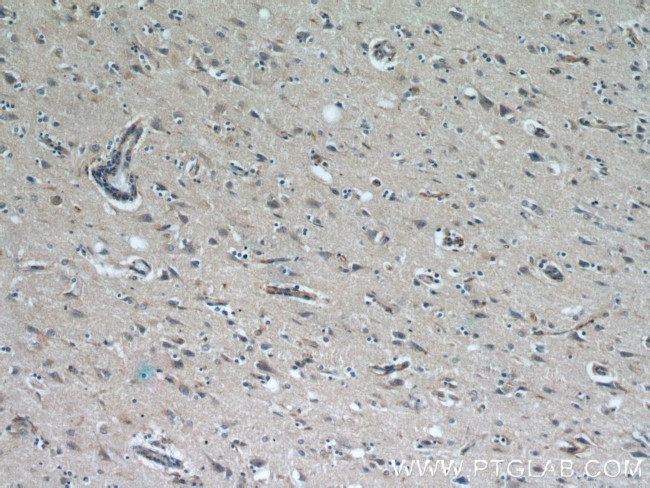 Syntaxin 12 Antibody in Immunohistochemistry (Paraffin) (IHC (P))