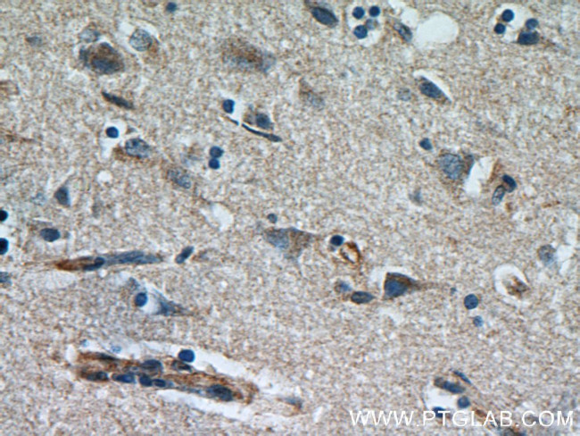 Syntaxin 12 Antibody in Immunohistochemistry (Paraffin) (IHC (P))