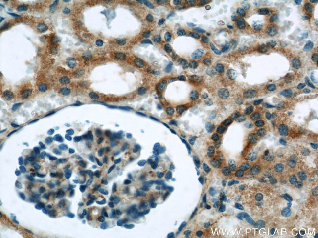 Syntaxin 12 Antibody in Immunohistochemistry (Paraffin) (IHC (P))