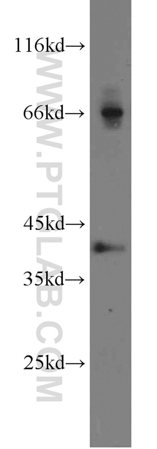 Syntaxin 12 Antibody in Western Blot (WB)