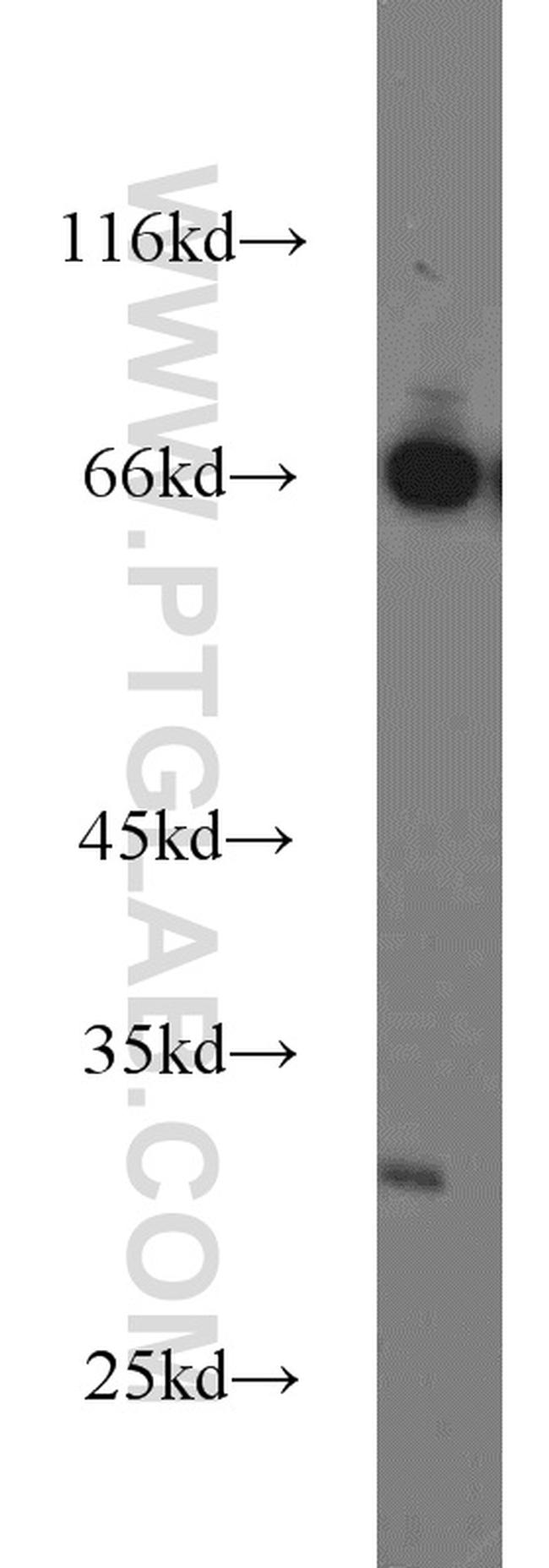 Syntaxin 12 Antibody in Western Blot (WB)