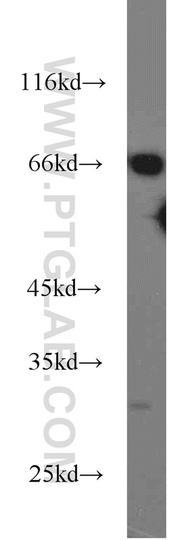 Syntaxin 12 Antibody in Western Blot (WB)