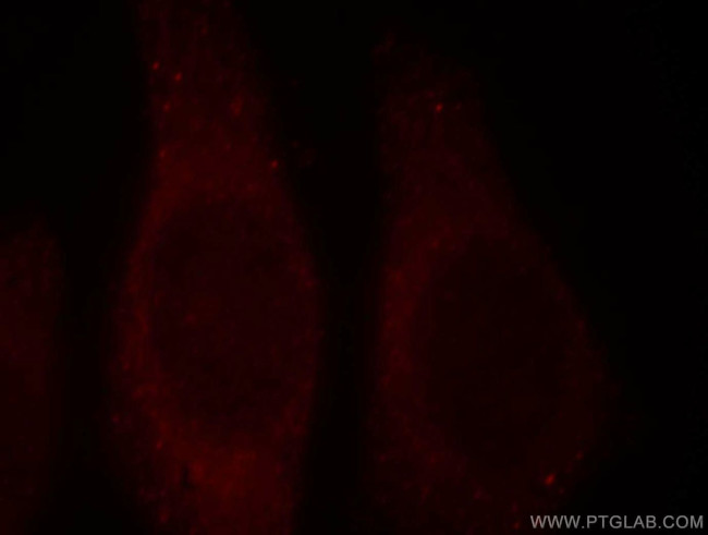 PNPLA6 Antibody in Immunocytochemistry (ICC/IF)