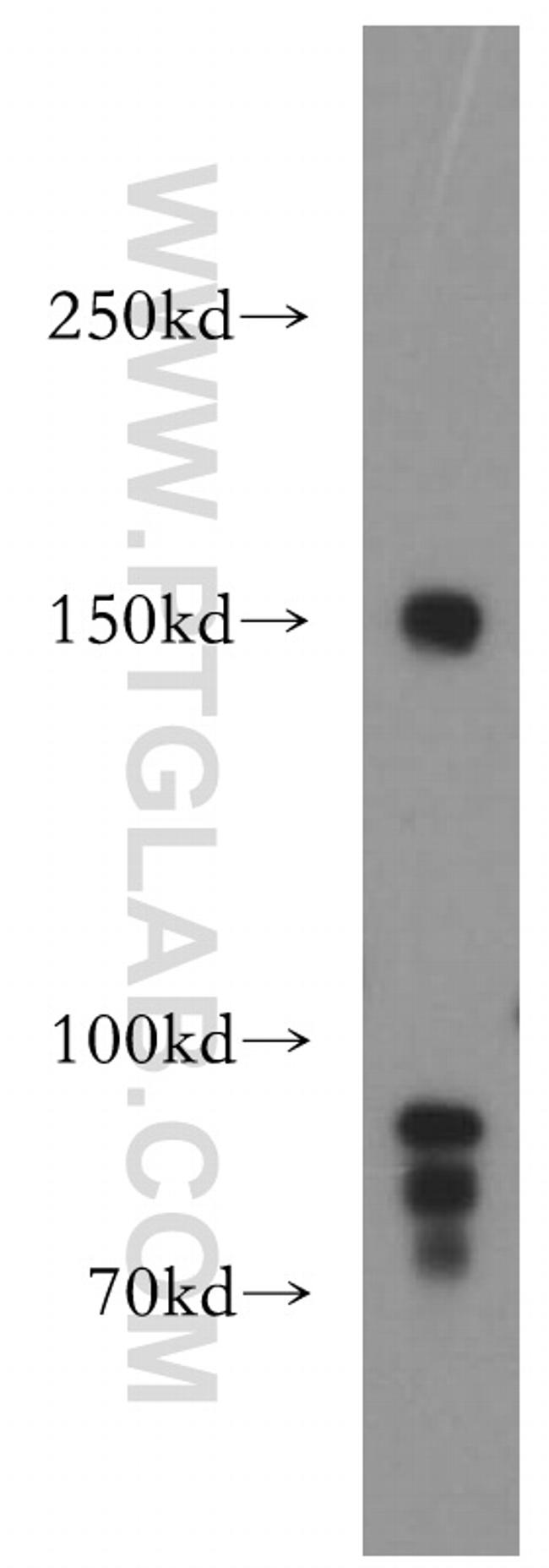 PNPLA6 Antibody in Western Blot (WB)