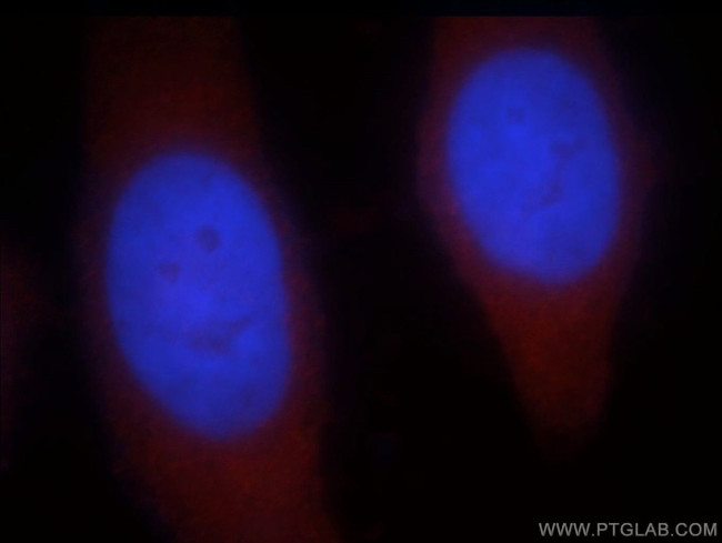 PNPLA6 Antibody in Immunocytochemistry (ICC/IF)