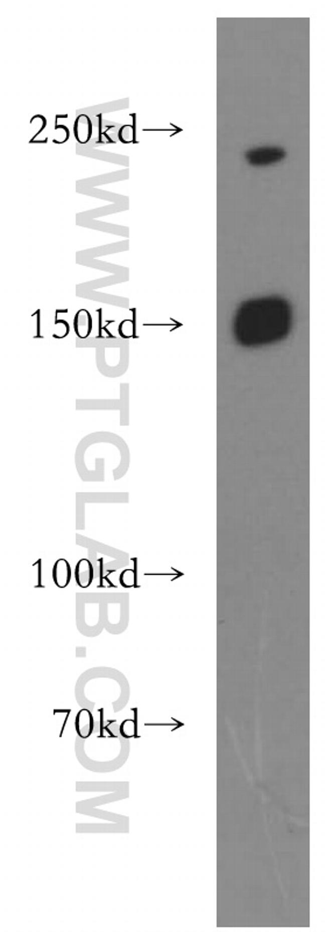 PNPLA6 Antibody in Western Blot (WB)