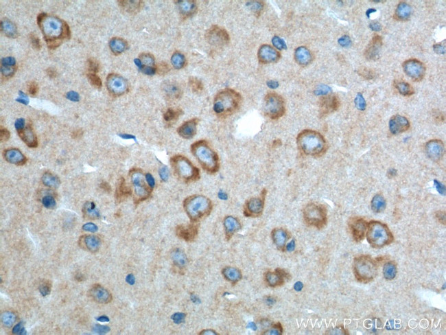 ADRA2A Antibody in Immunohistochemistry (Paraffin) (IHC (P))